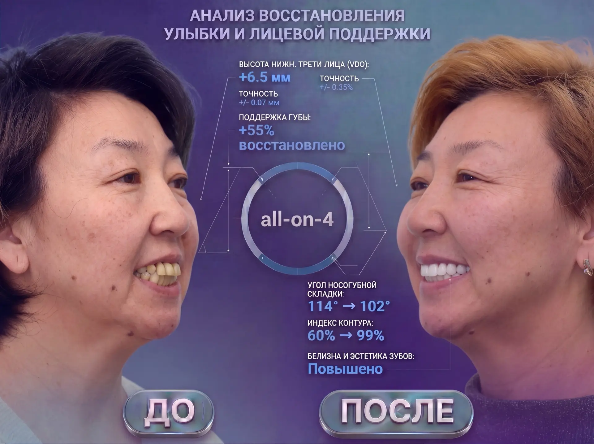 👌«Когда нет проблем с зубами — это счастье!»