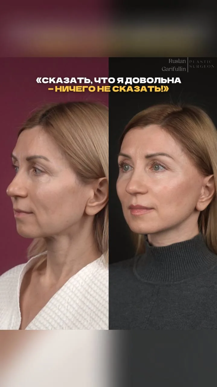 ✨ Естественная красота в 47 лет 👇