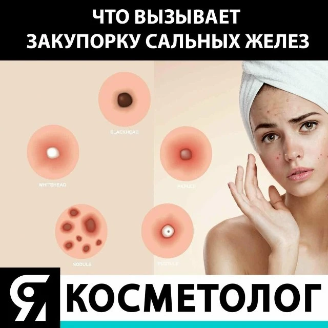 Список веществ, вызывающих закупорку сальных желез: 👇