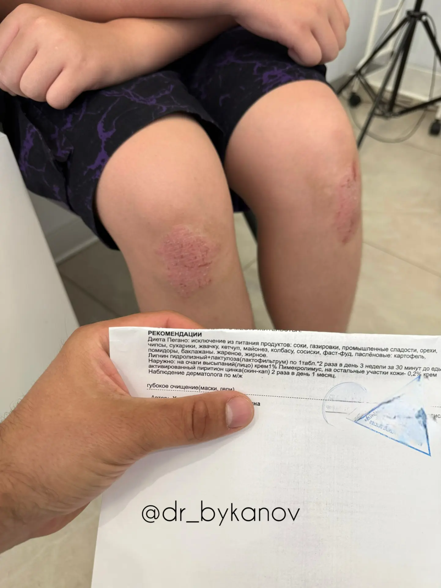 Ох уж эти чистки кишечника при псориазе…