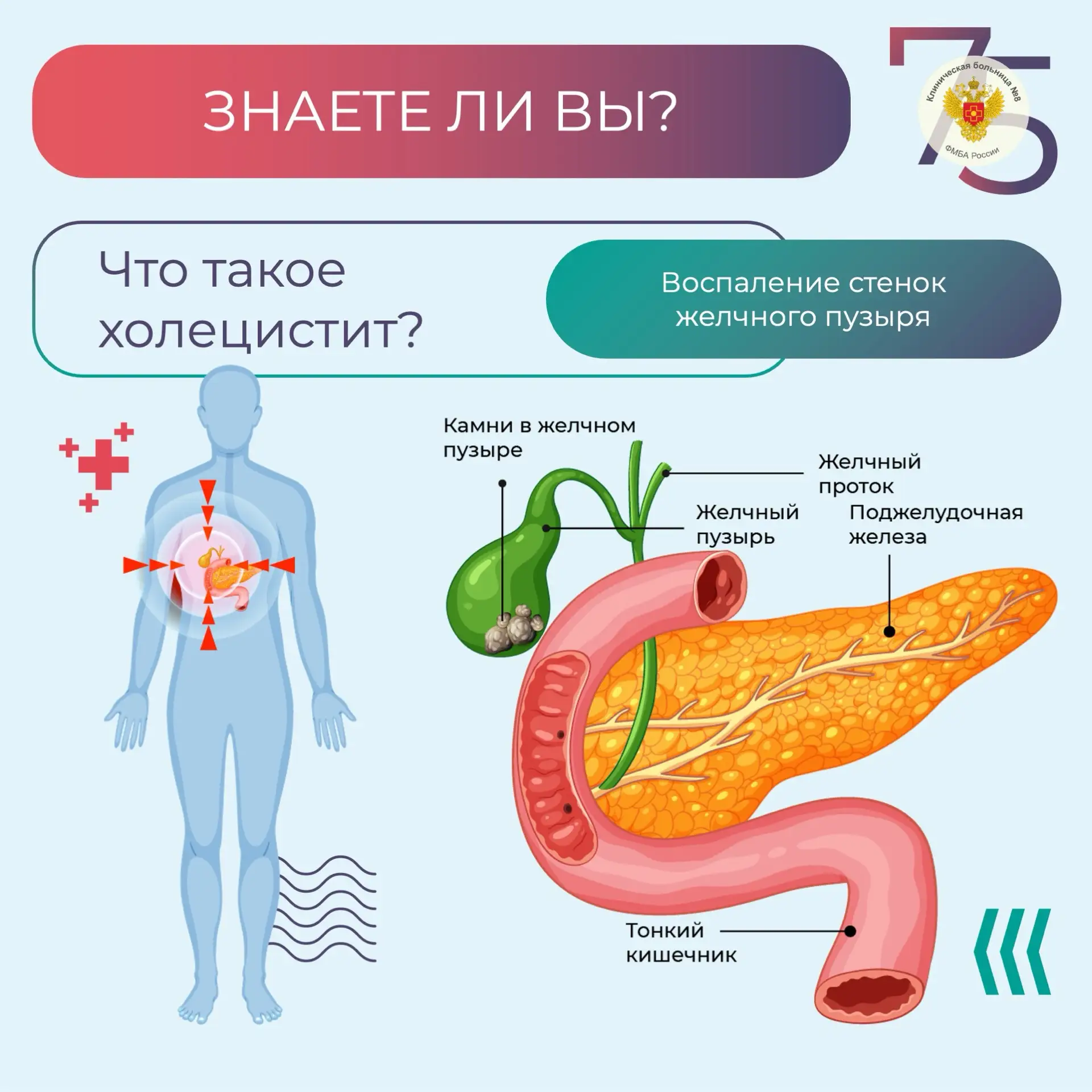 Холецистит и желчнокаменная болезнь. Что делать?

🔹 Если коротко: желчнокаменная болезнь — причина,