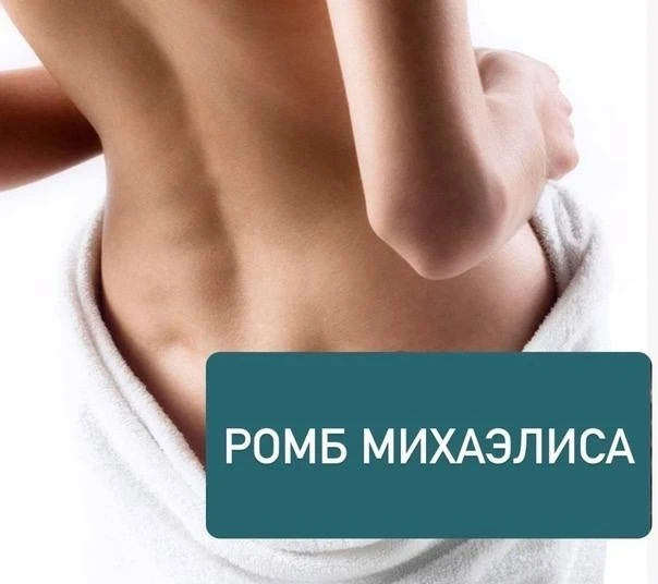 Ромб Михаэлиса (лат. rhombus Michaelis) — это ромбовидное образование в нижней части спины, играющее
