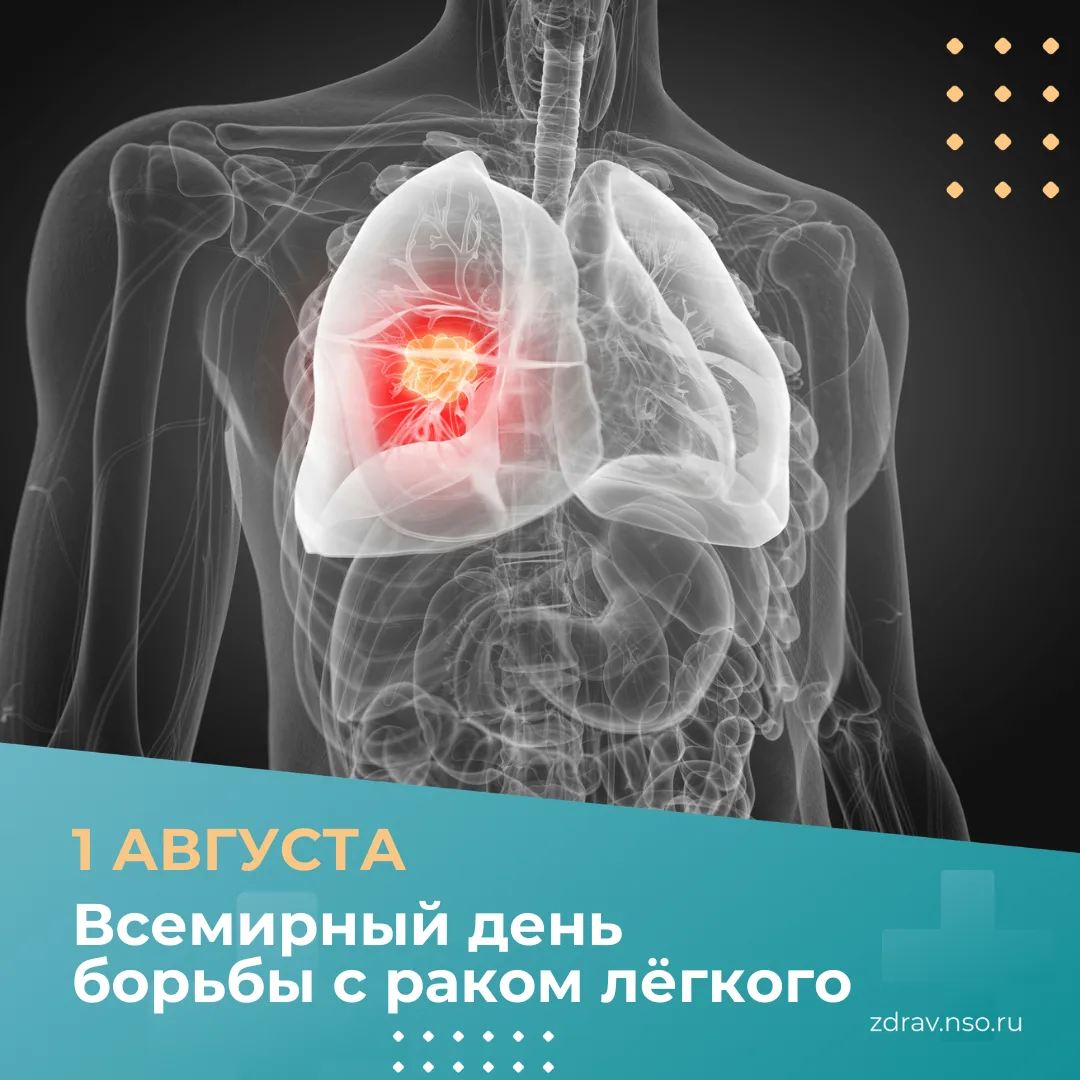 Рак легкого остается одним из самых коварных онкологических заболеваний. Главной, но не...