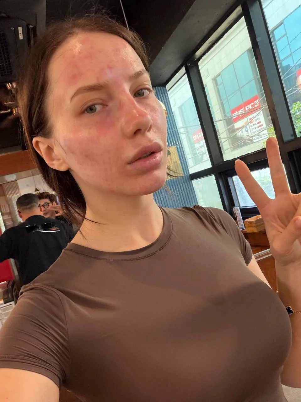 Я в шоке что с моим лицом 🤯
Хожу в маске и очках потому что это полный пипец 🥺