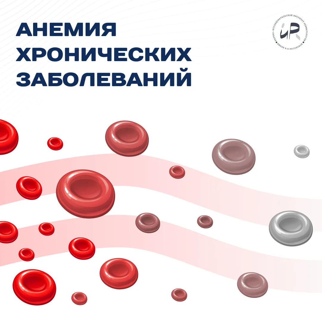 ➔ Анемия хронических заболеваний у пациентов с ревматическими заболеваниями

Анемия представляет соб