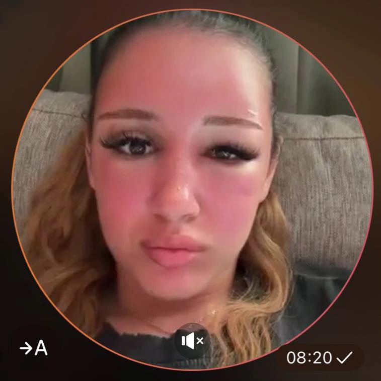 стало всё только хуже🥺🥺