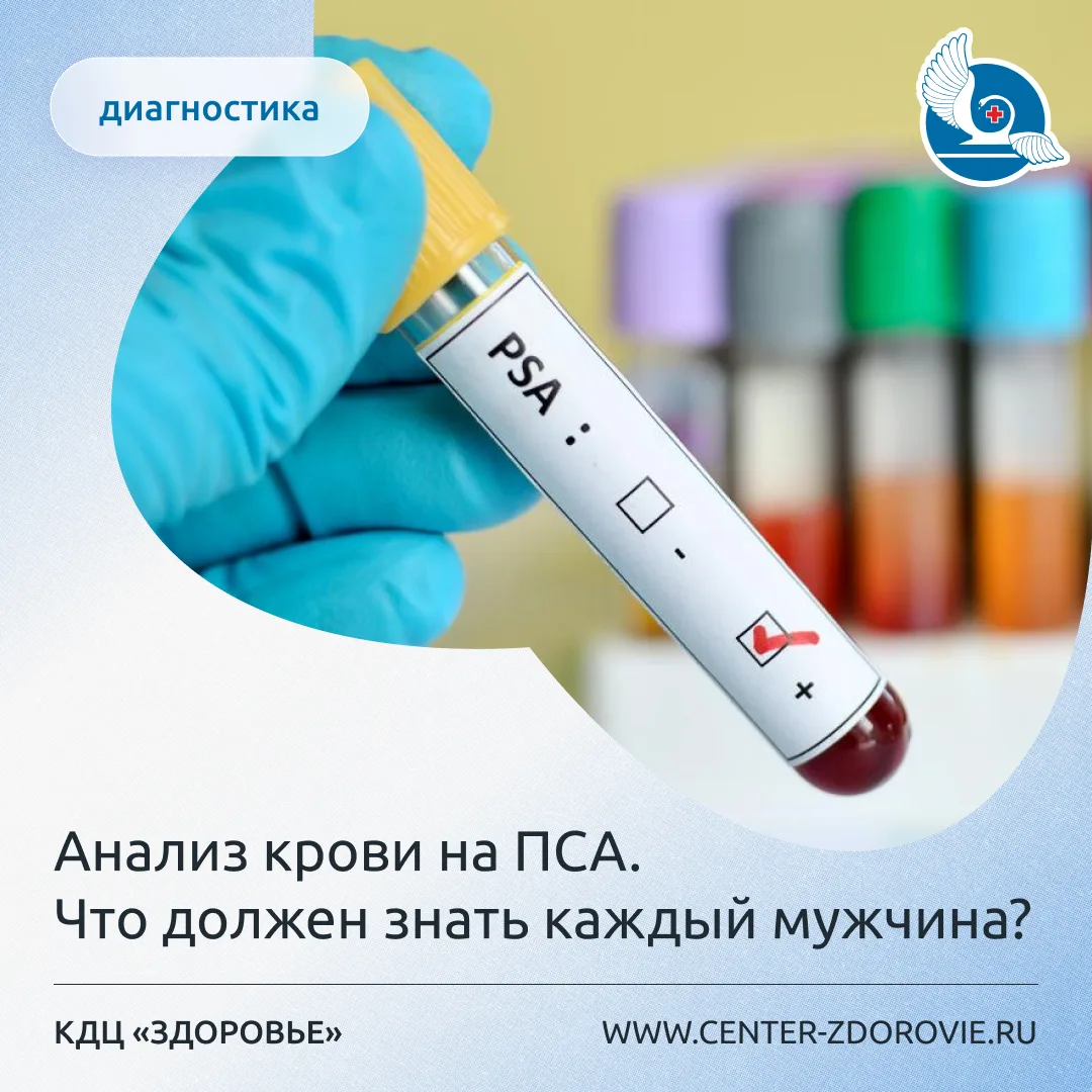 Анализ крови на ПСА. Что должен знать каждый мужчина?

Простатспецифический антиген (ПСА) — это бело