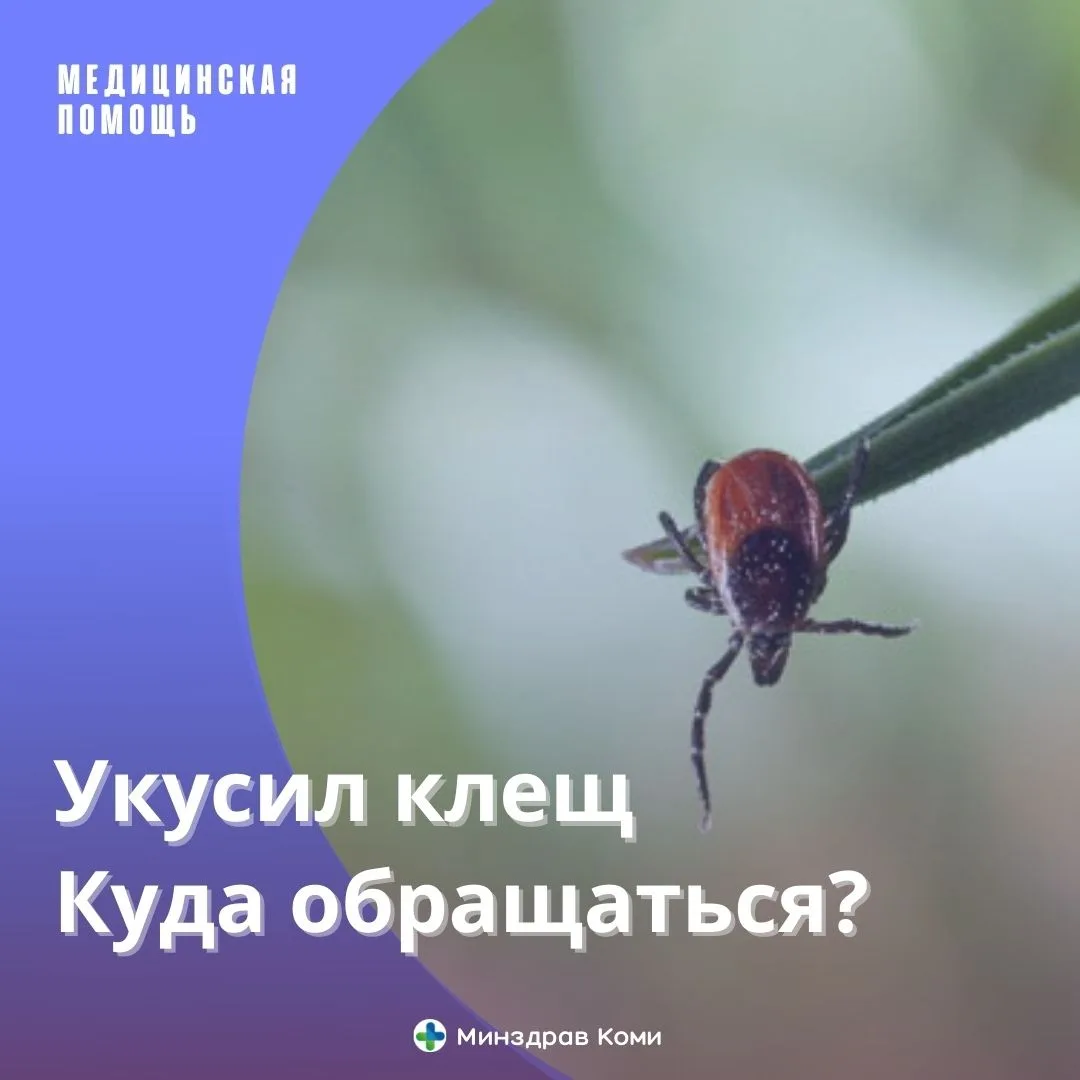 В Республику Коми поступило почти 50 тысяч доз вакцины от клещевого вирусного энцефалит...