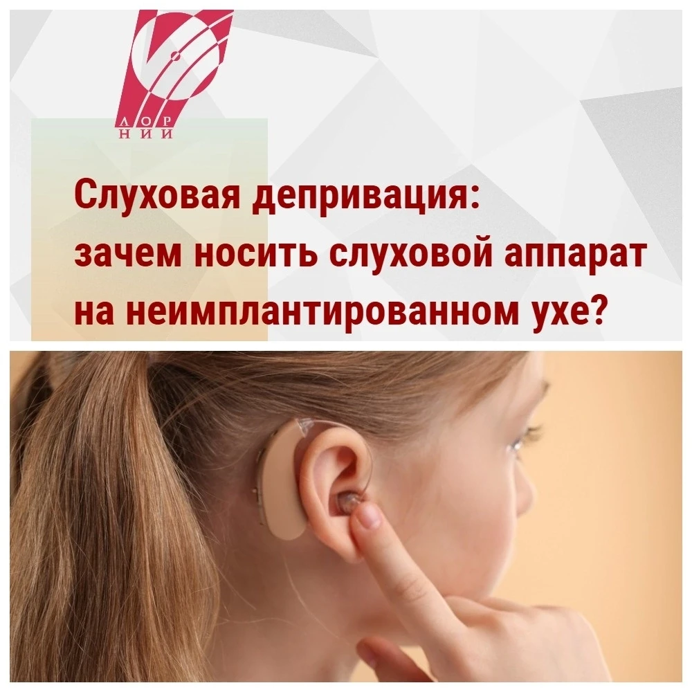 🦻 Слуховая депривация: зачем носить слуховой аппарат на неимплантированном ухе?