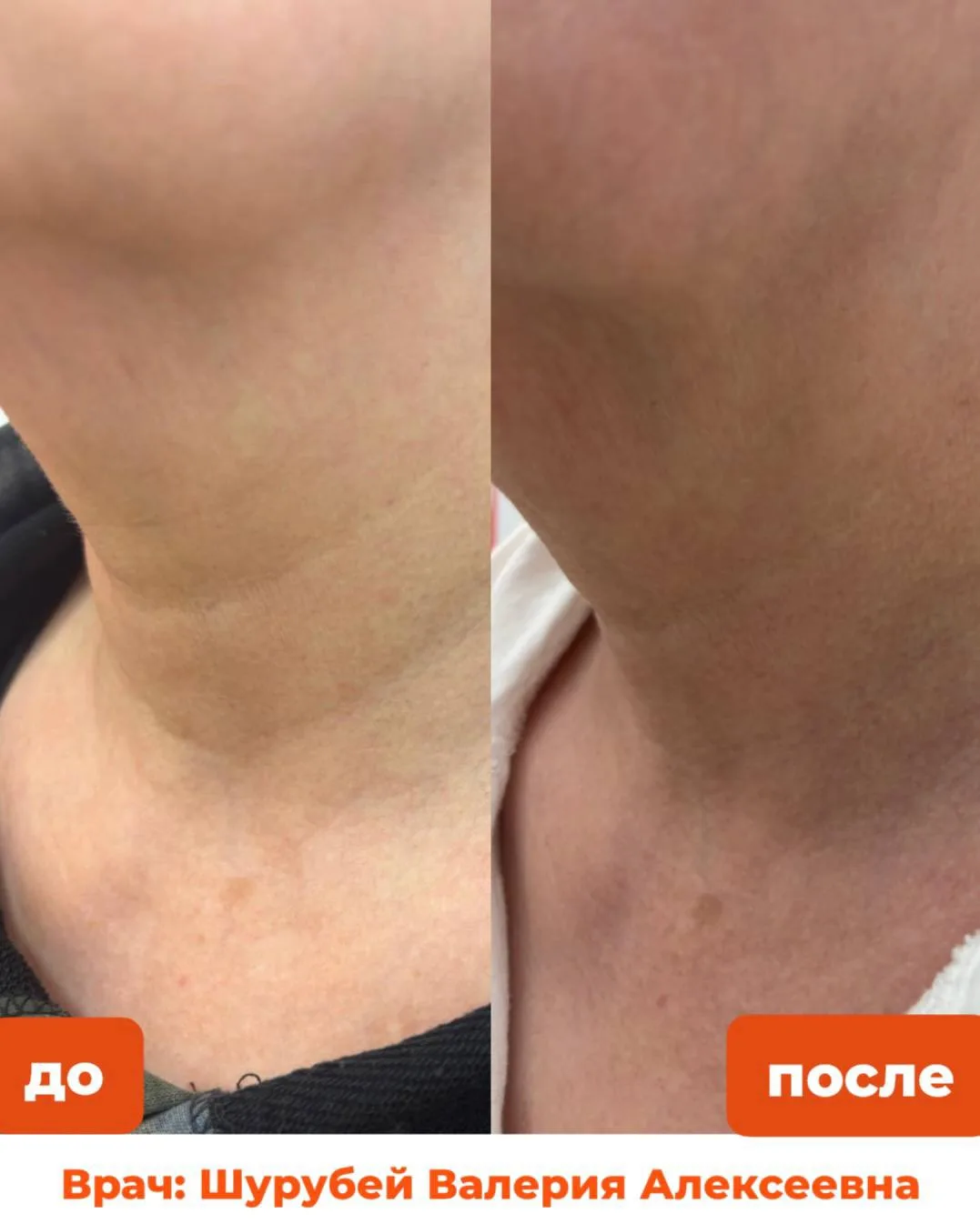 Зачастую мы идём в косметологию, чтобы преобразить кожу лица. Делаем эстетические процедуры, инъекци