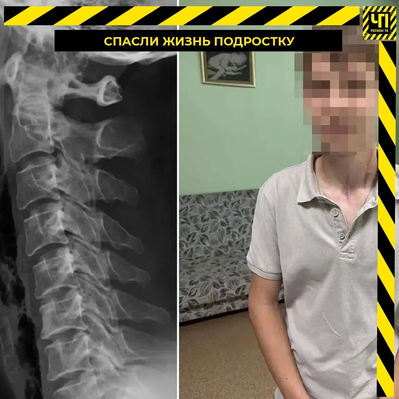 Изображение 1 к публикации «ЧП и ДТП | Регион 74 | Челябинск и область»