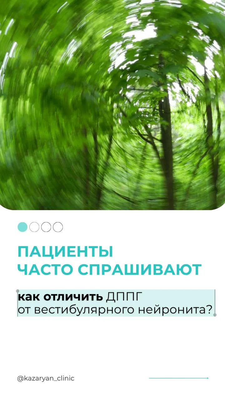 Хотя отличия ДППГ и вестибулярного нейронита глобальны,  спутать сложно, вопрос все рав...