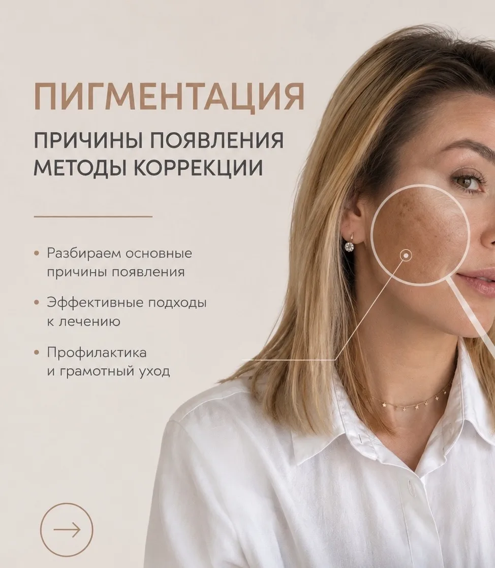 💬 «Как бороться с пигментацией?»