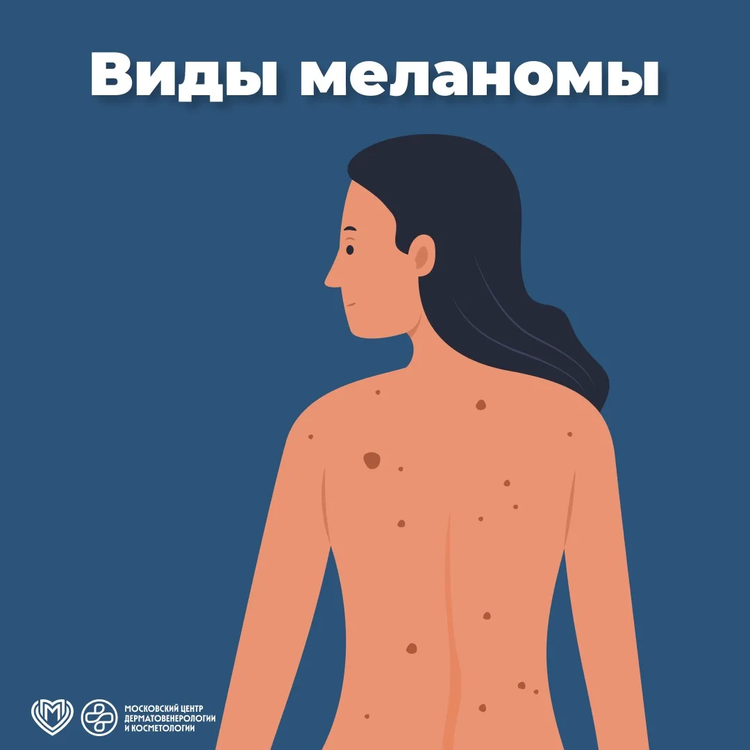 👆🏻 Вчера мы начали разговор о самом опасном злокачественном кожном заболевании, сегод...