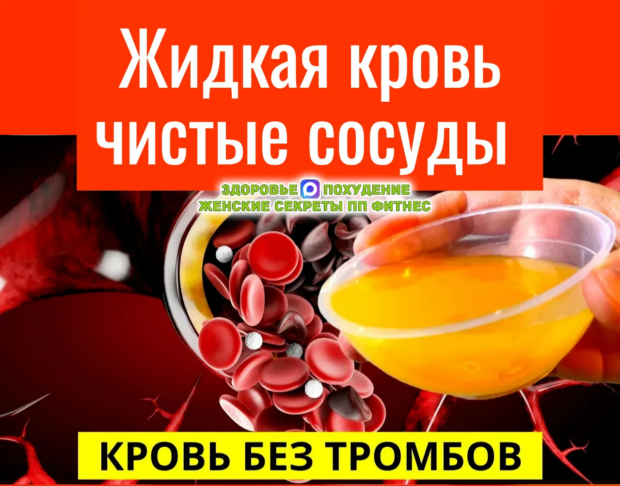 💧 Разжижаем кровь и избавляемся от тромбозов без таблеток

🍽 Морская капуста — помогает поддержива
