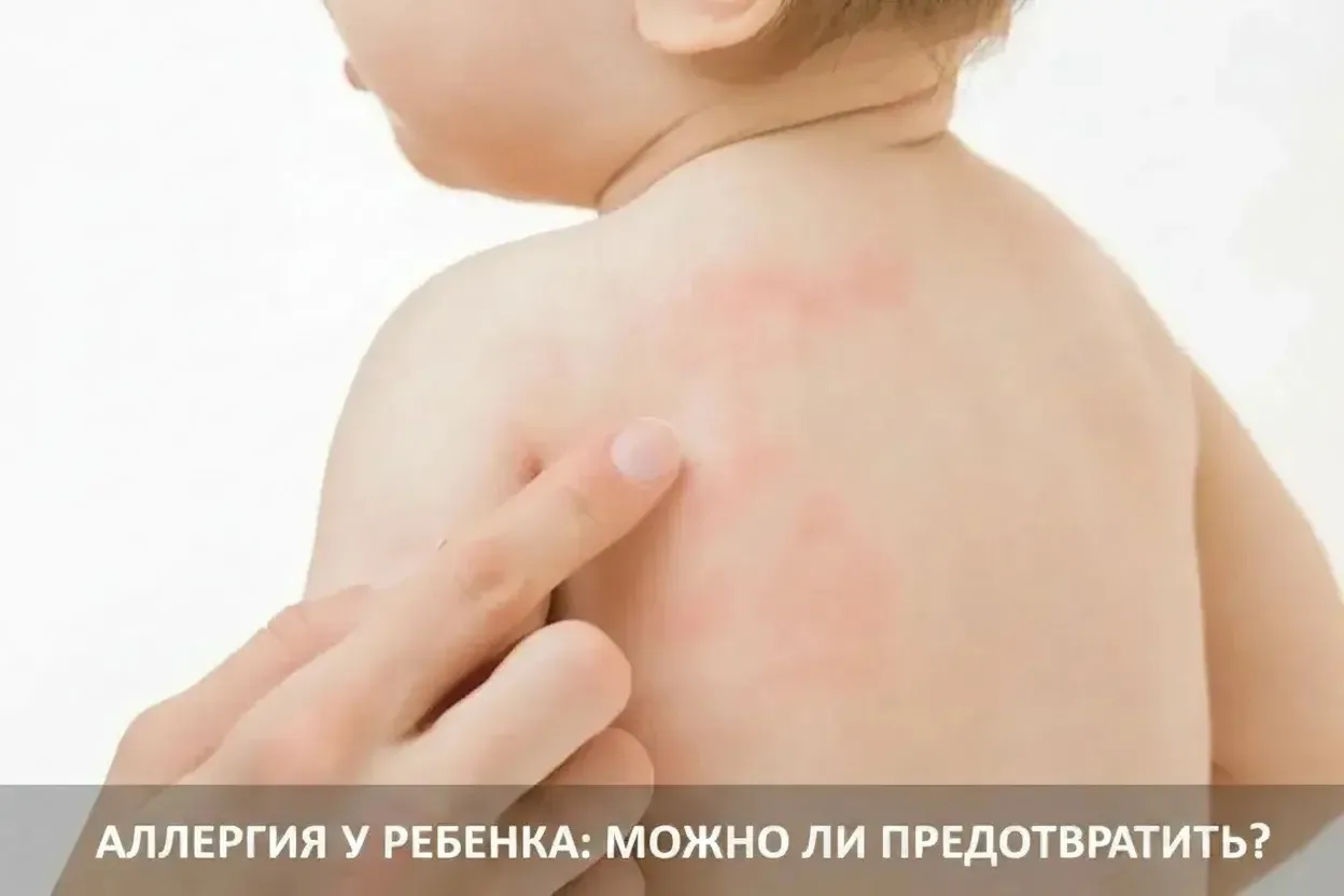 🤰 Аллергия у малыша: можно ли предотвратить? Отвечаем на главные вопросы Недели профилактики аллерг