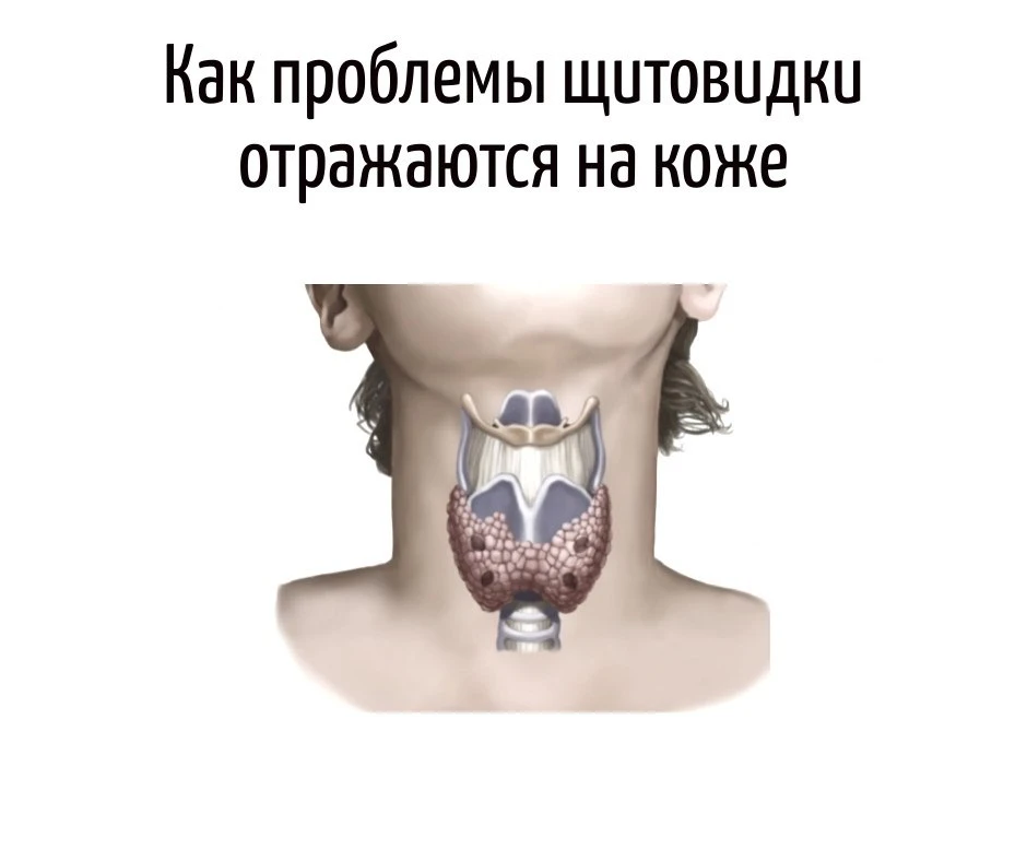 Наш организм — умнейшая система. И иногда он подаёт сигналы не болью, а… кожей. Особенно если дело к