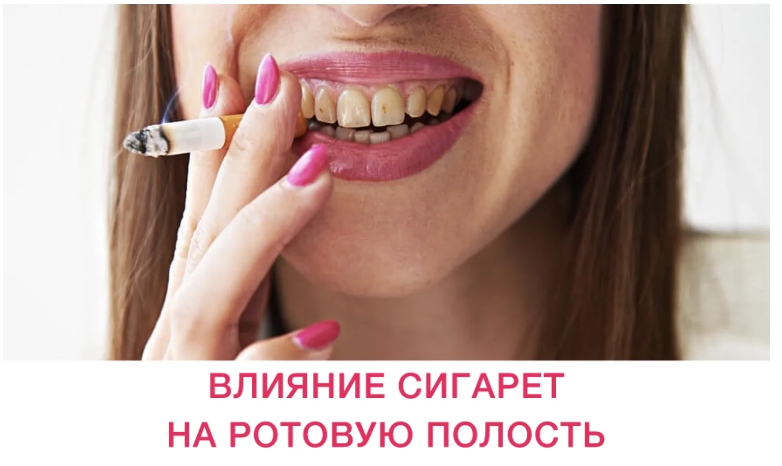 Как курение воздействует на зубы?