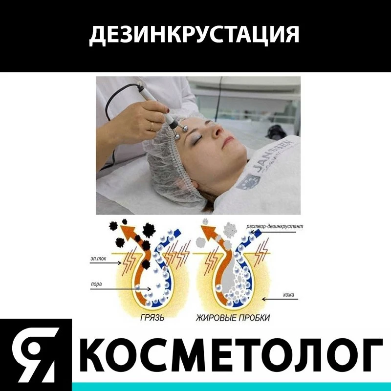 Дезинкрустация, или гальваническая чистка - очищение пор при помощи гальванического ток...