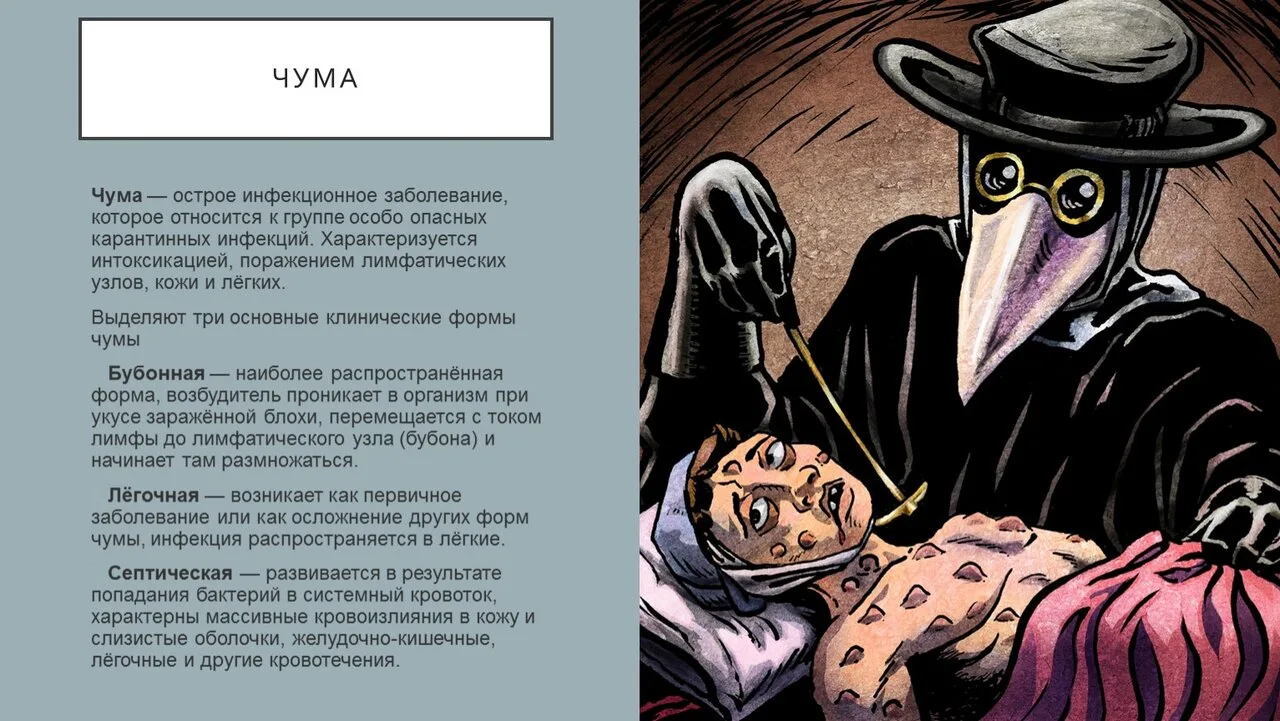 😷 В России зафиксировали смерть от чумы — сотрудница противочумного института умерла о...