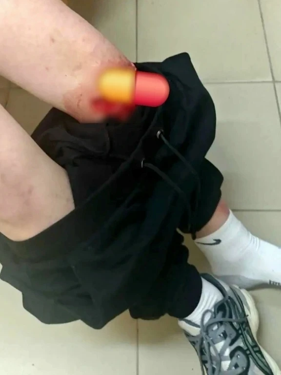 Фото не для слабонервных‼