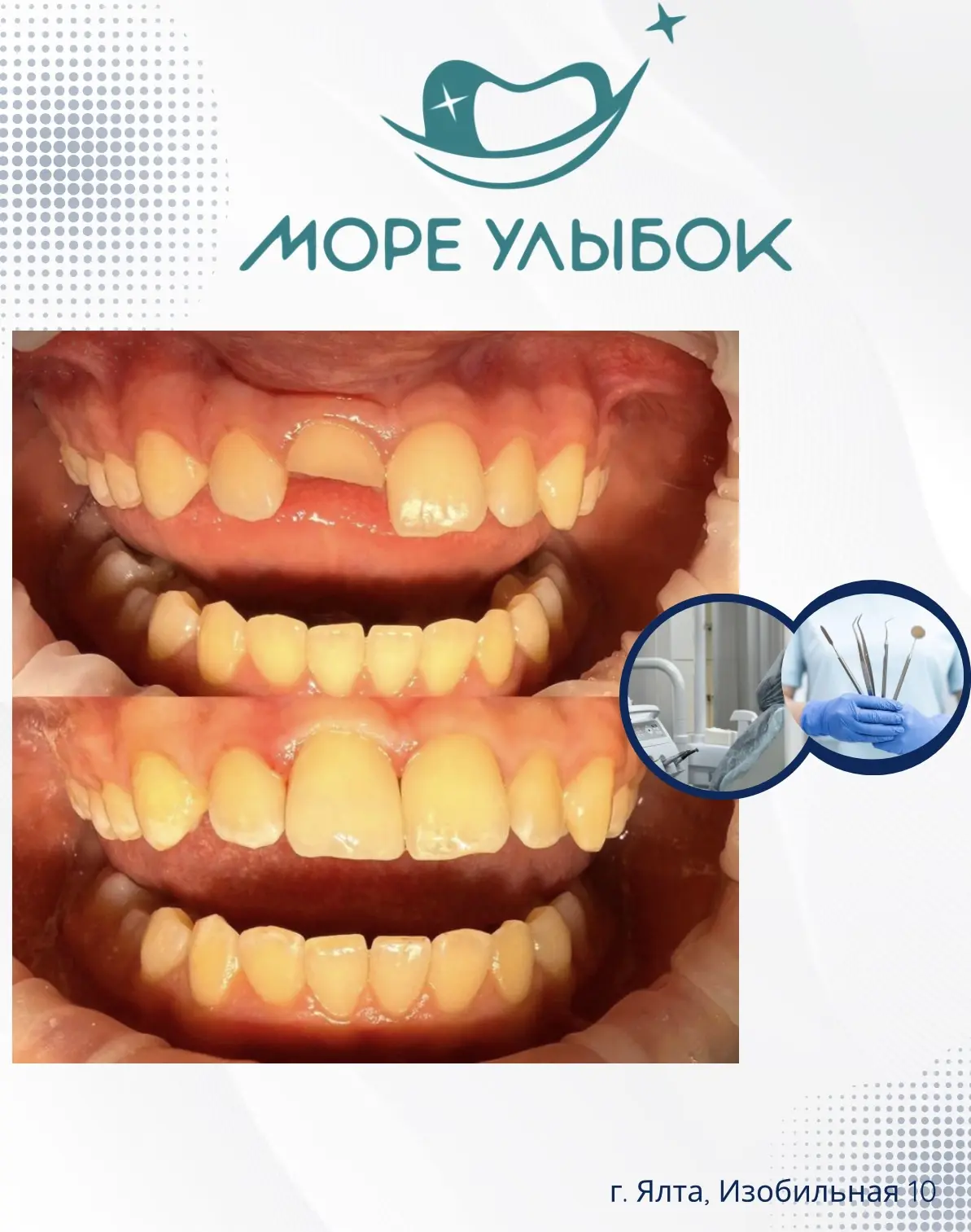 🦷 Травма зуба — это всегда неожиданно. Еще секунду назад зуб был здоровым, и вдруг — п...