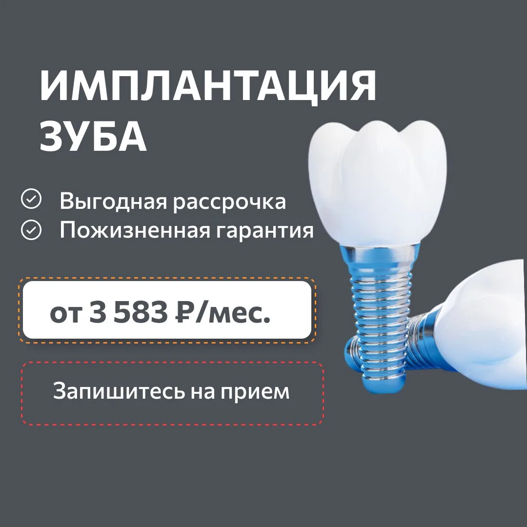 Имплантация зубов в Красноярске от 3 583 ₽/мес.