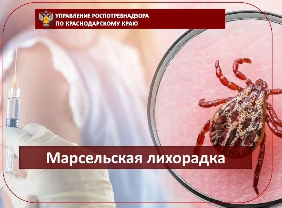 Марсельская лихорадка