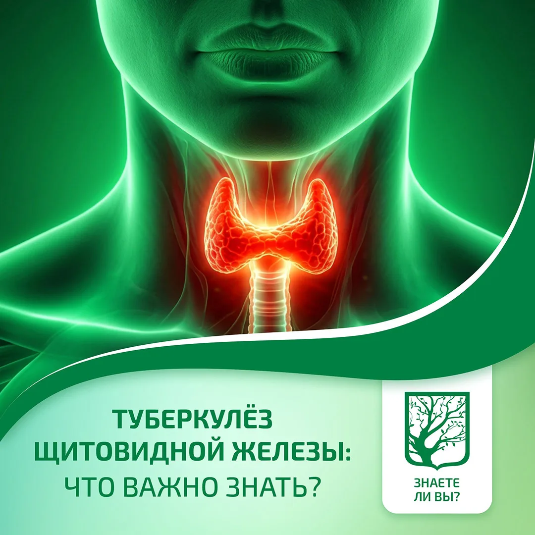 Туберкулёз щитовидной железы: что важно знать?