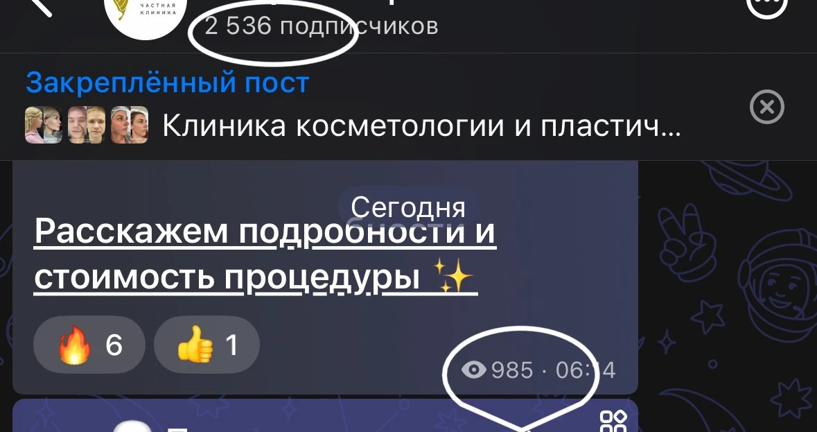 Охваты на одном из клиентских аккаунтов. Пост был утром. К вечеру 40% подписчиков увиде...