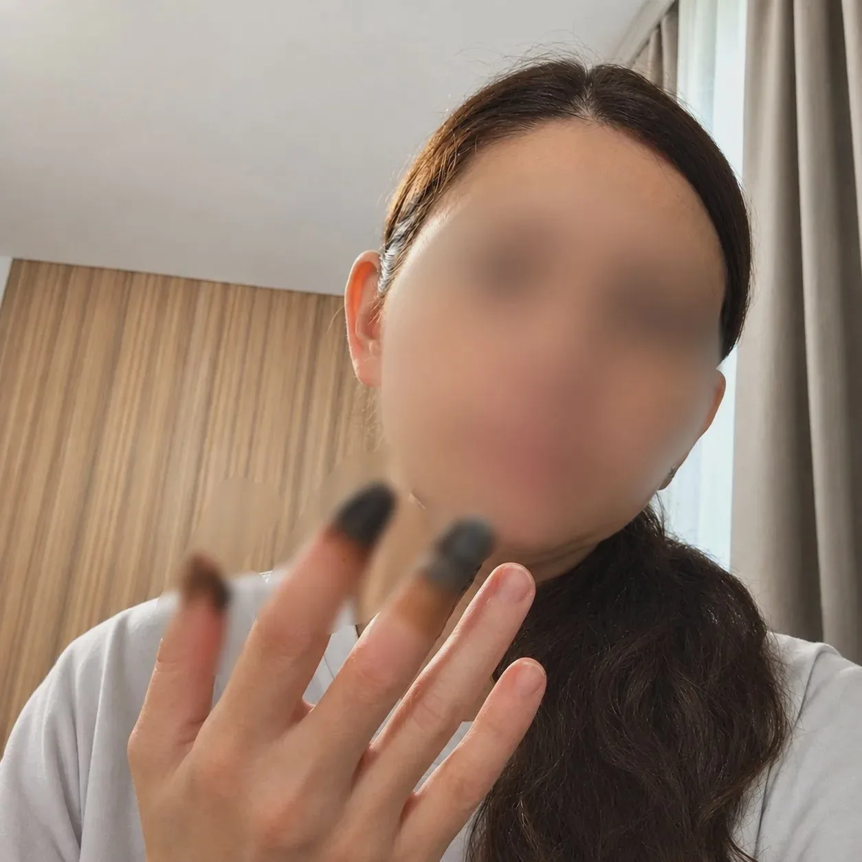 После родов сочинке готовят операцию на пальцах