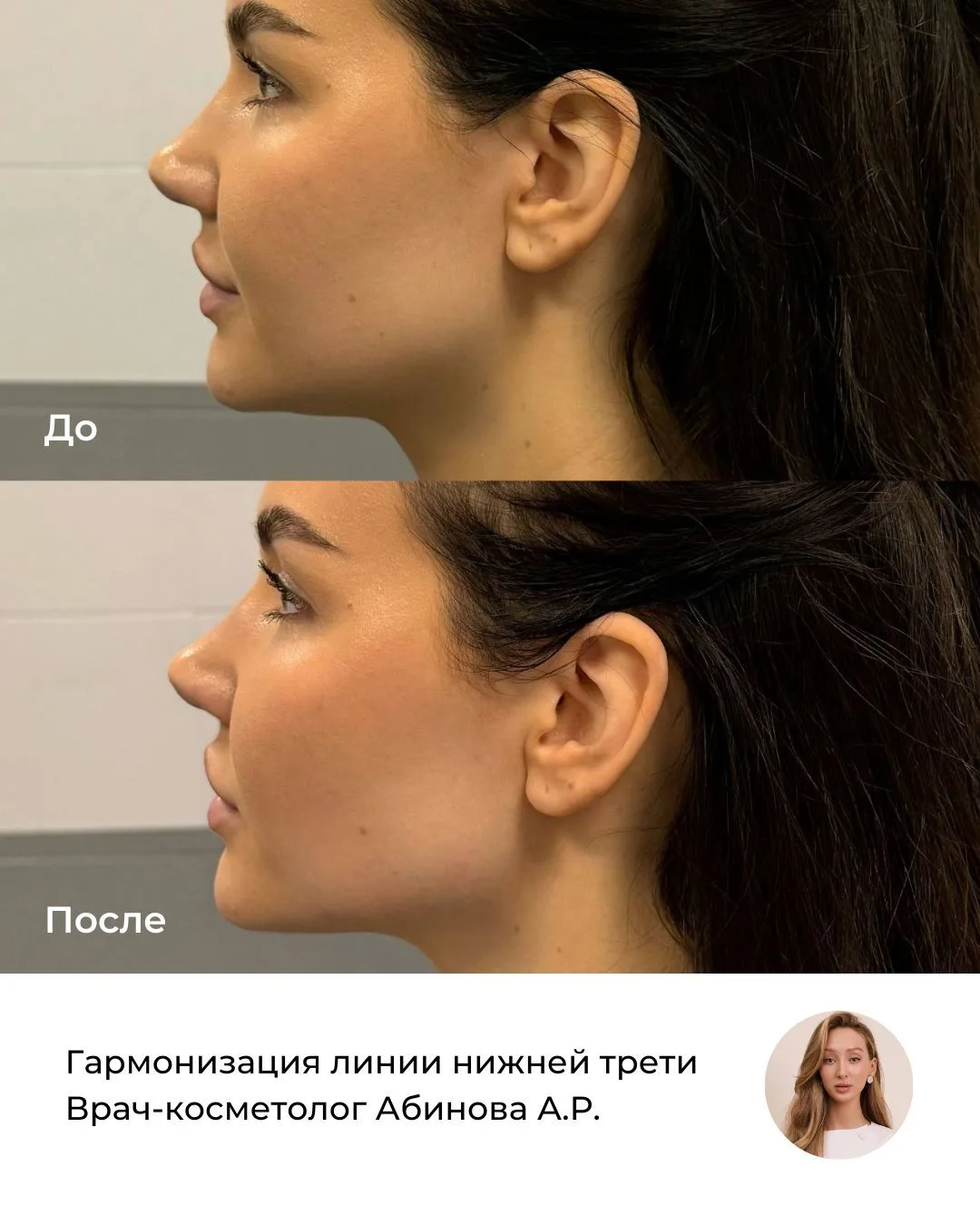 Чётче контур, гармоничнее пропорции ✨