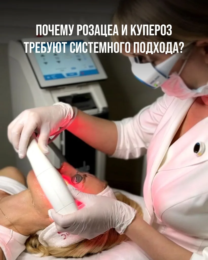 Почему розацеа и купероз требуют системного подхода?

Мы работаем с куперозом и розацеа более 15 лет