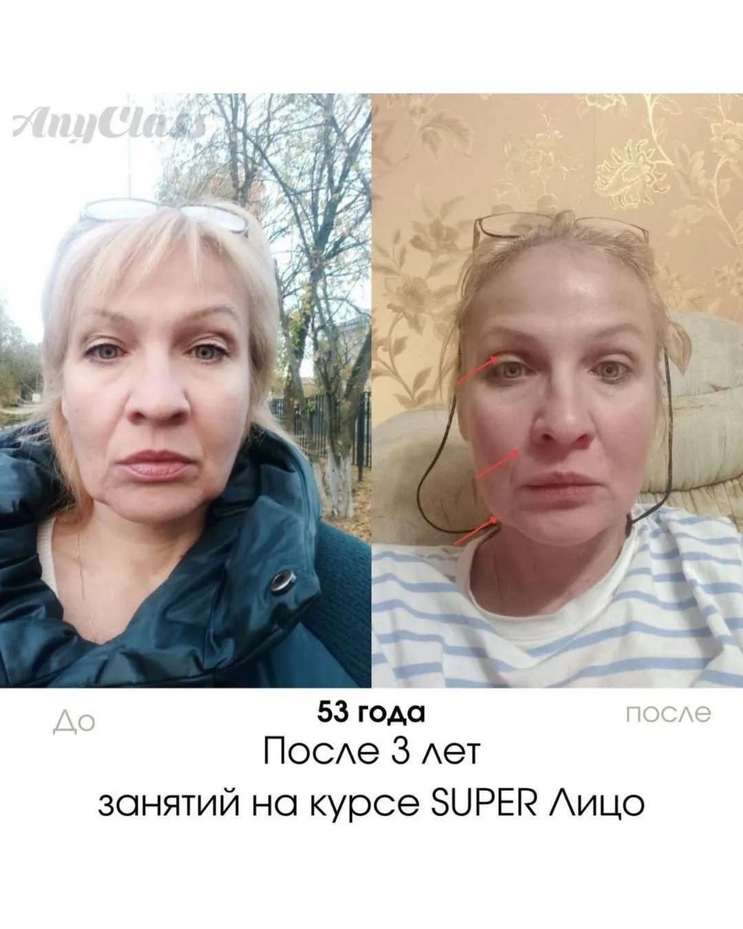 Изображение 2 к публикации «Гимнастика для лица»