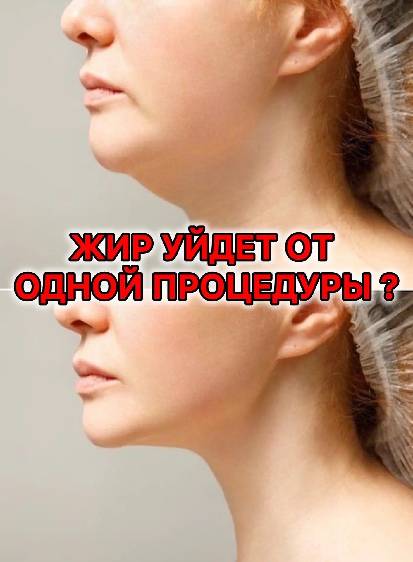 Представьте себе процедуру, которая способна подарить видимый результат уже после первого сеанса. Зв