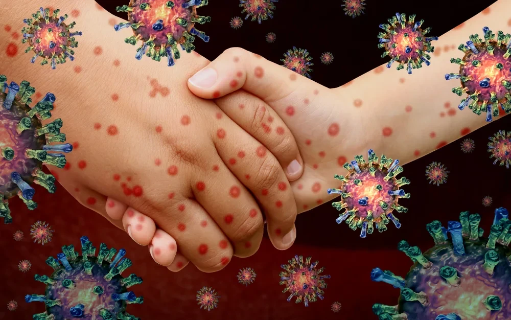 🦠 Специалисты Центра гигиены и эпидемиологии рассказывают, как защитить себя и близких от энтеровир