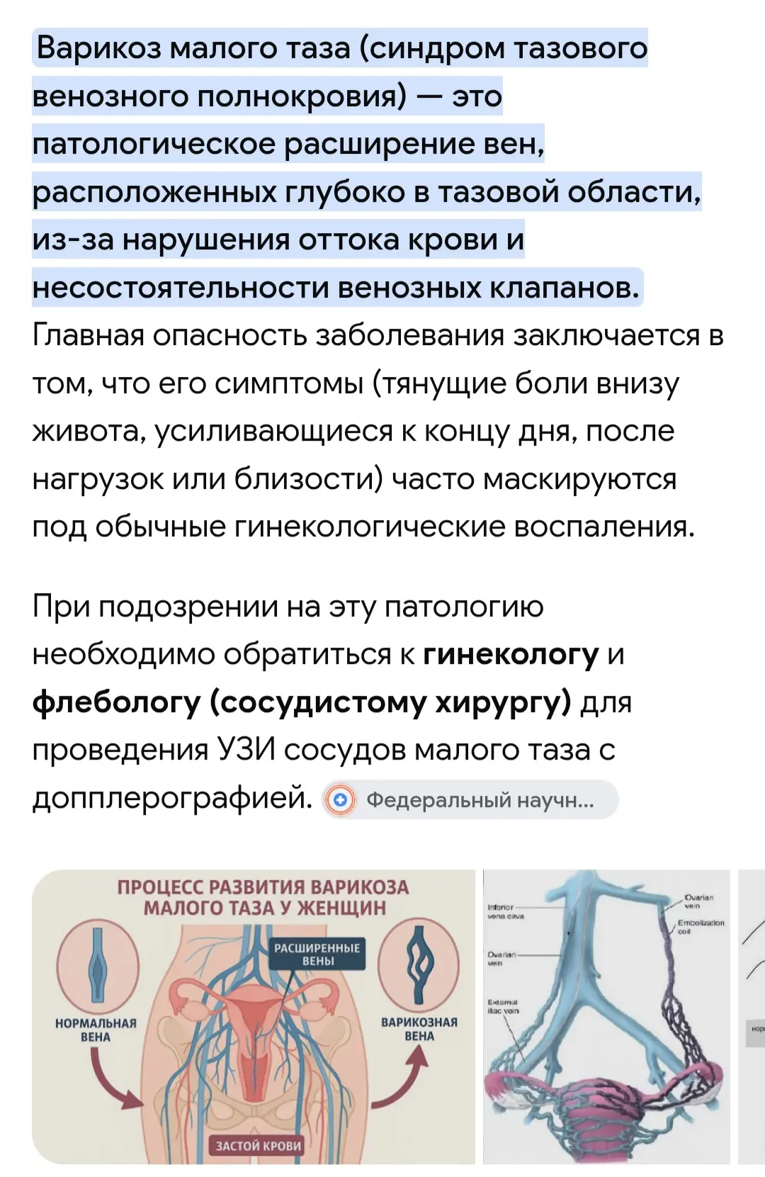 Варикоз малого таза ✅ причины возникновения и пути решения