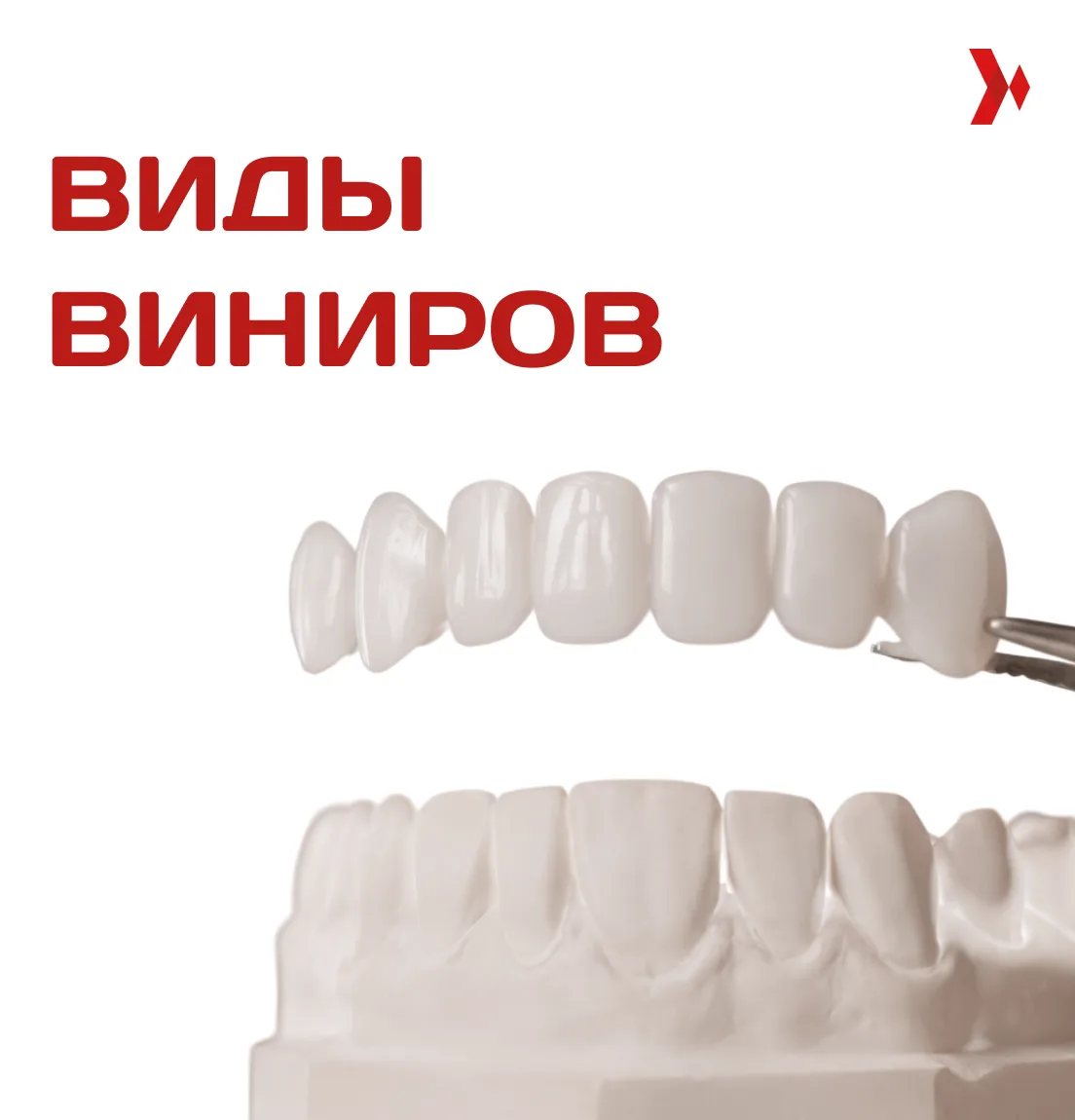 Выбираете виниры, но не знаете, какие подойдут именно вам?