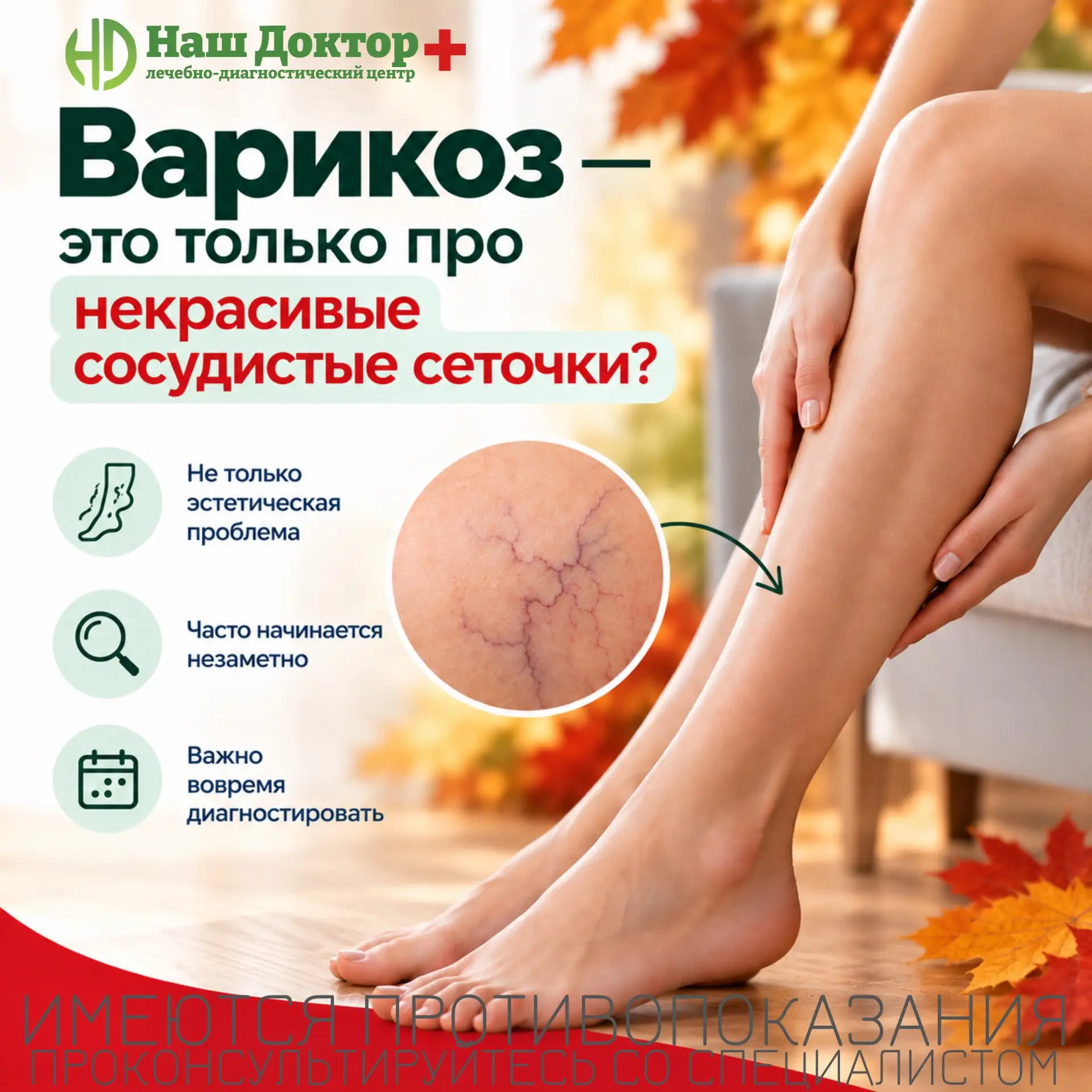 Варикоз - это только про некрасивые сосудистые сеточки? 🤔