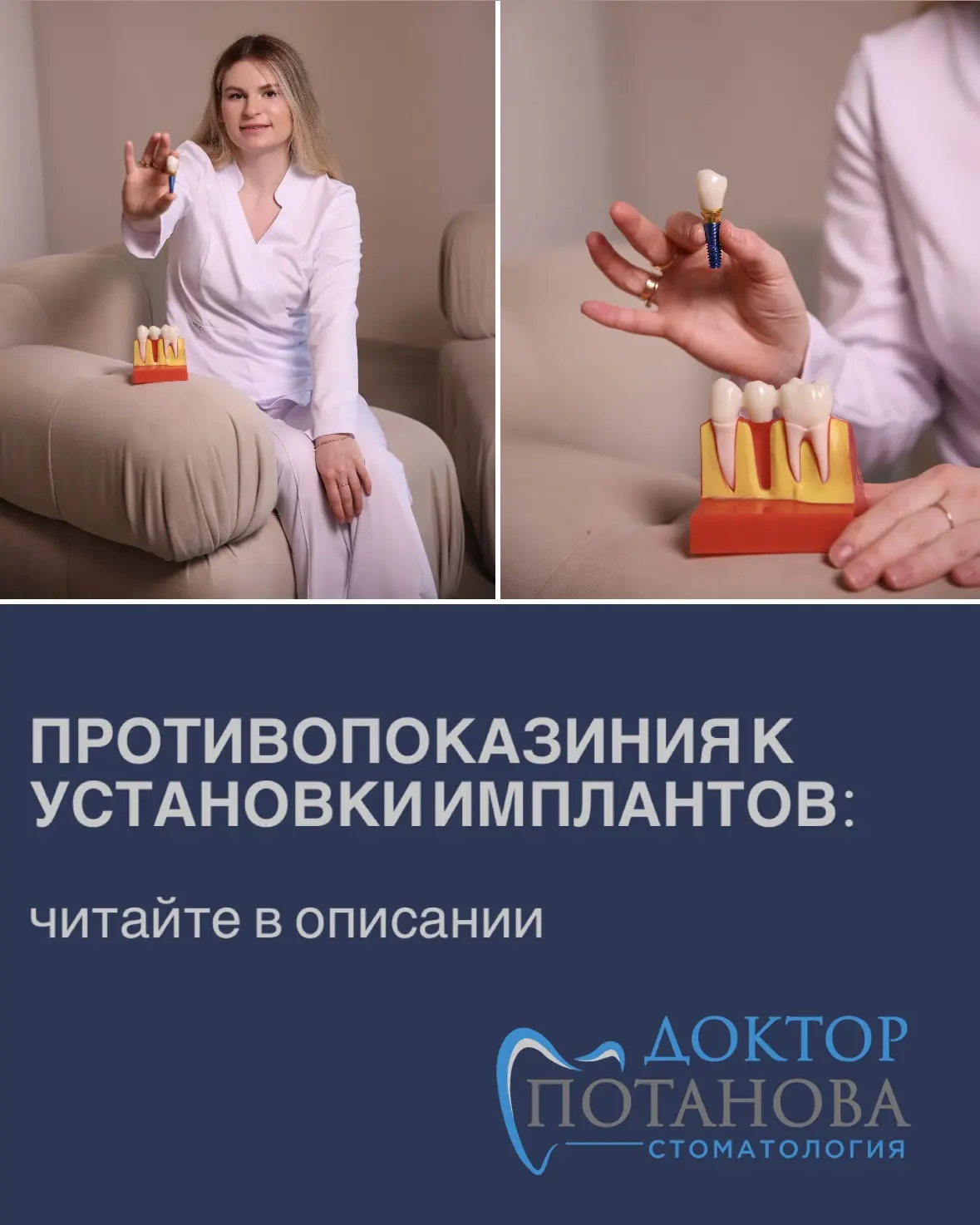 Противопоказания к установке имплантов: