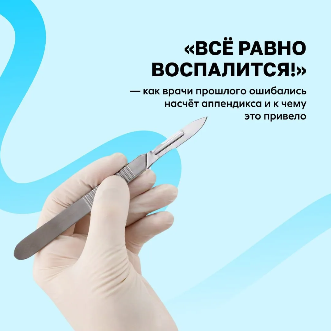 🌱 Почему раньше аппендикс удаляли всем подряд?