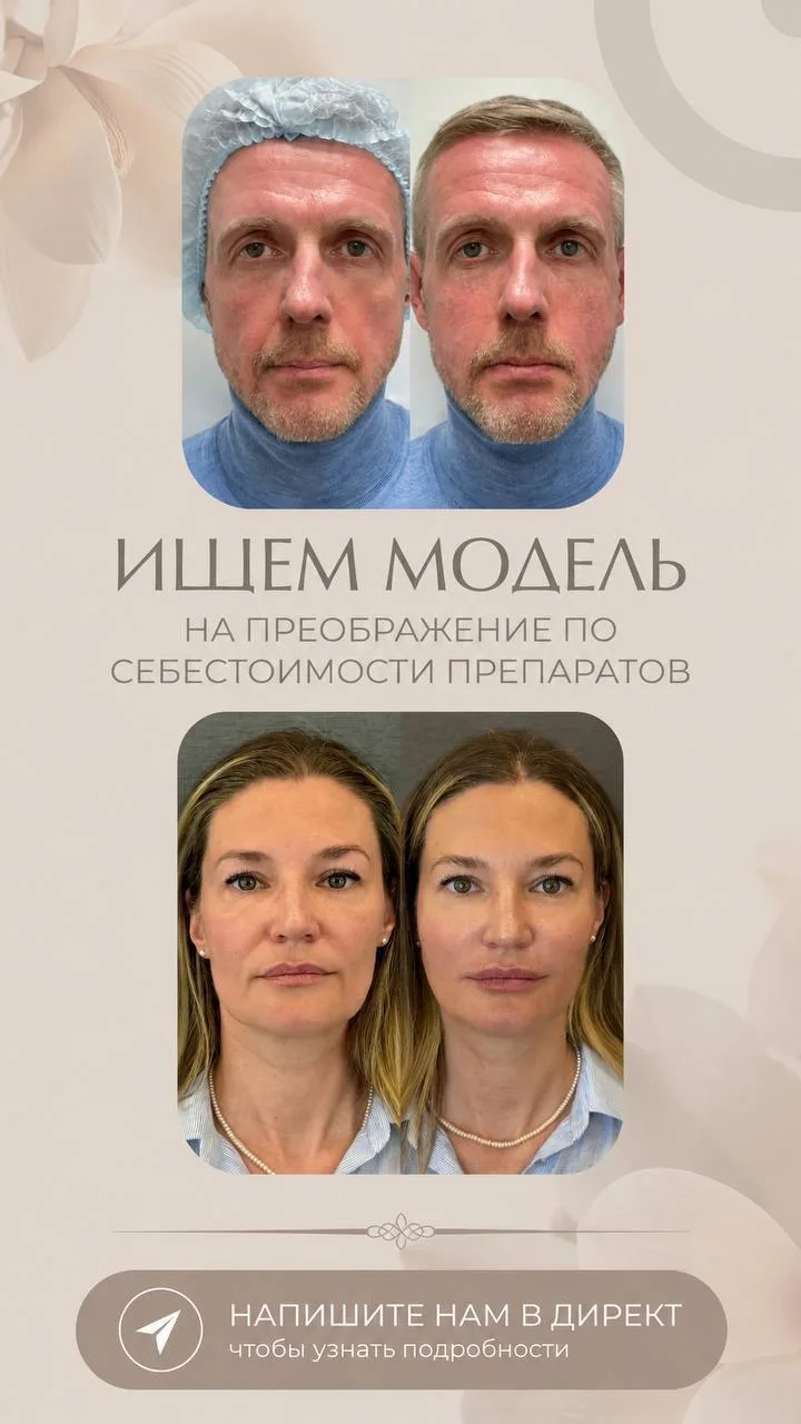 🔥Ищем модель на комплексное омоложение по себестоимости препаратов 🔥