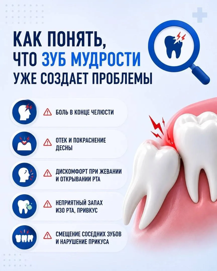 Как понять, что зуб мудрости уже создает проблемы?

Многие уверены: если зуб мудрости не болит — зна