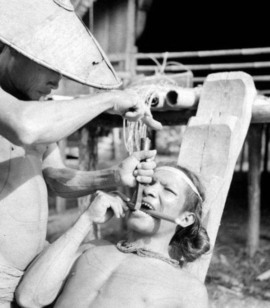 Заточка зубов у индонезийских племен и её результат, фотографии 1938 года.