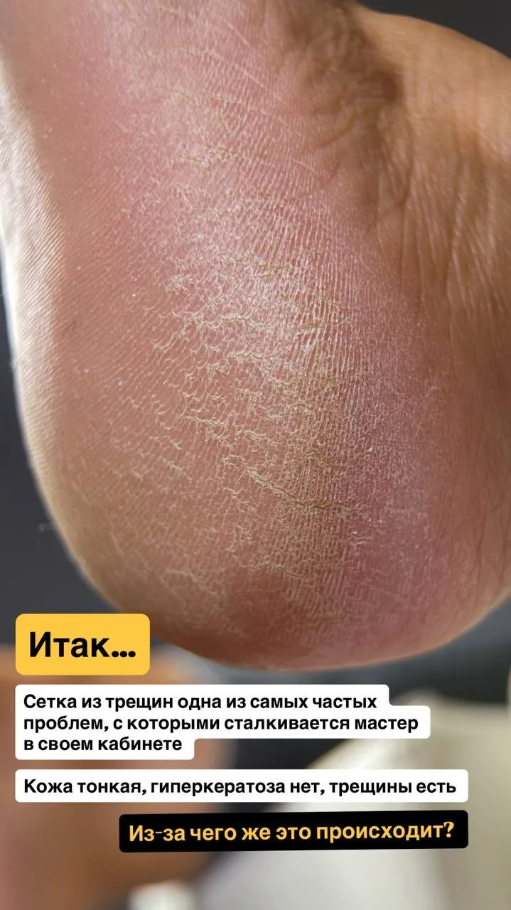 Сетка из трещин одна из самых частых проблем, с которыми сталкивается мастер