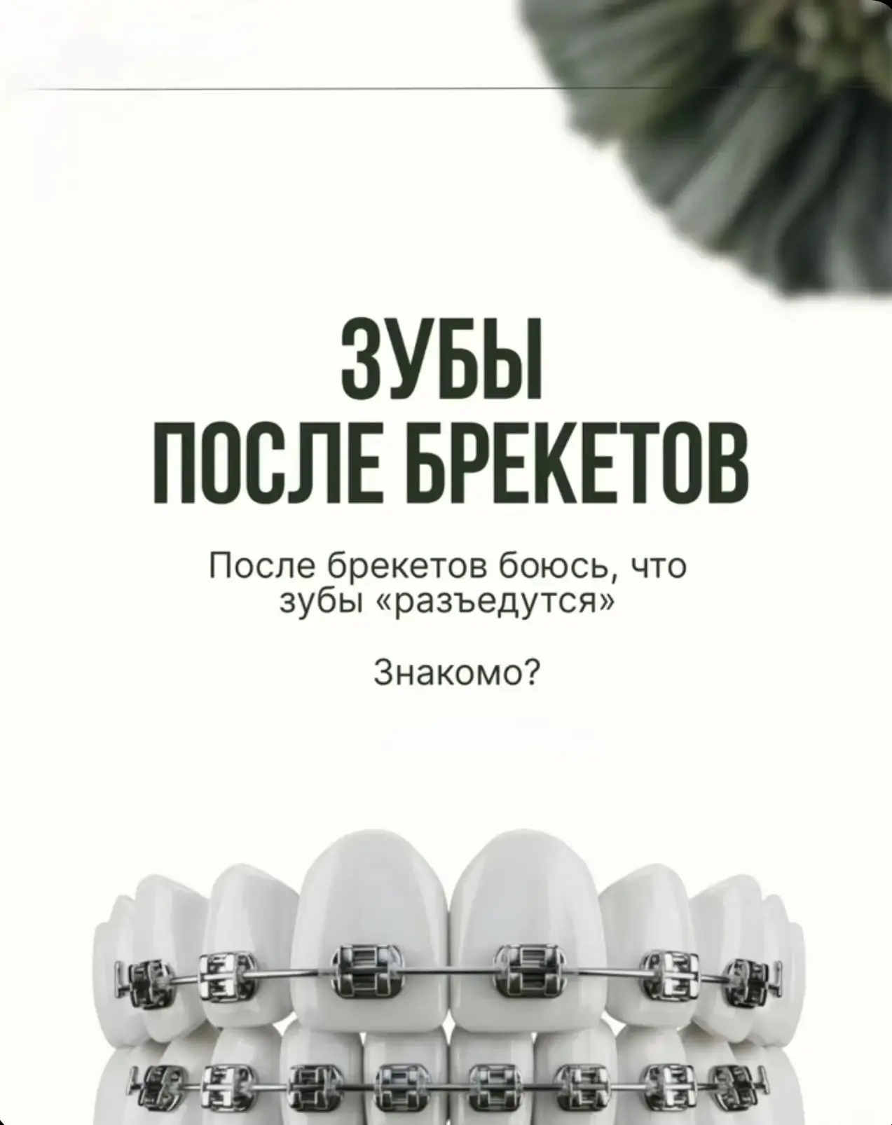 🦷 Зубы после брекетов: почему они «не разъедутся» (и что делать, чтобы так и было) 🦷

Сняли брекет