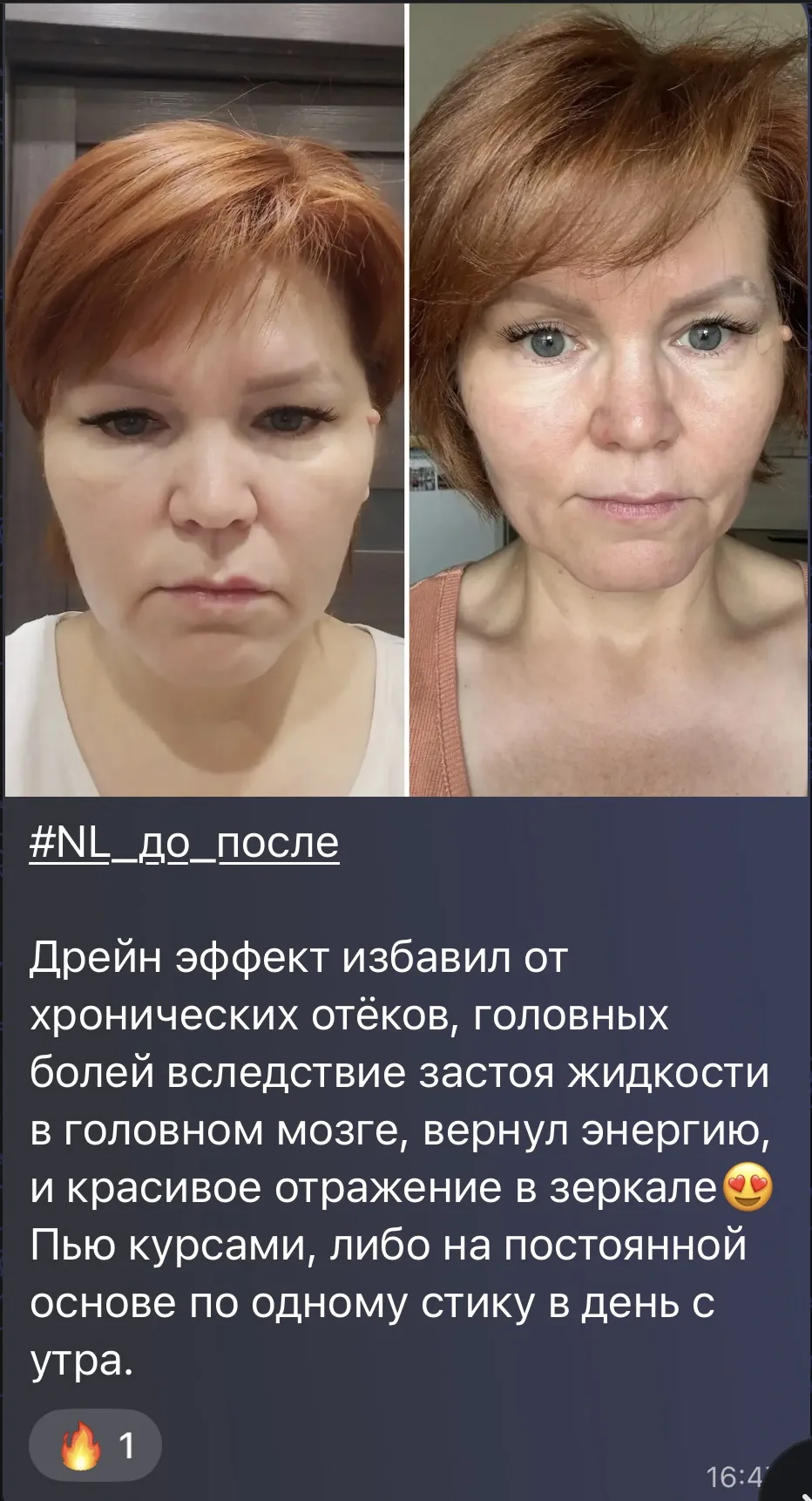 #детокс #детоксдоипосле #выведениежидкости #задержкажидкости #отеки #отечность #лимфодр...