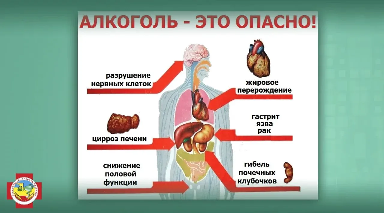 Многие привыкли считать, что «пара рюмок по праздникам» - это нормально. Но врачи Балаш...