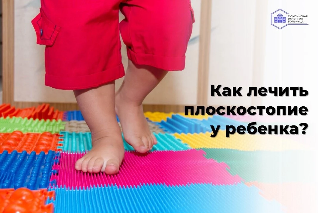 Плоскостопие не лечат ортопедической обувью. Жесткие ботинки с супинатором — миф. 
 
До 5–6 лет плос