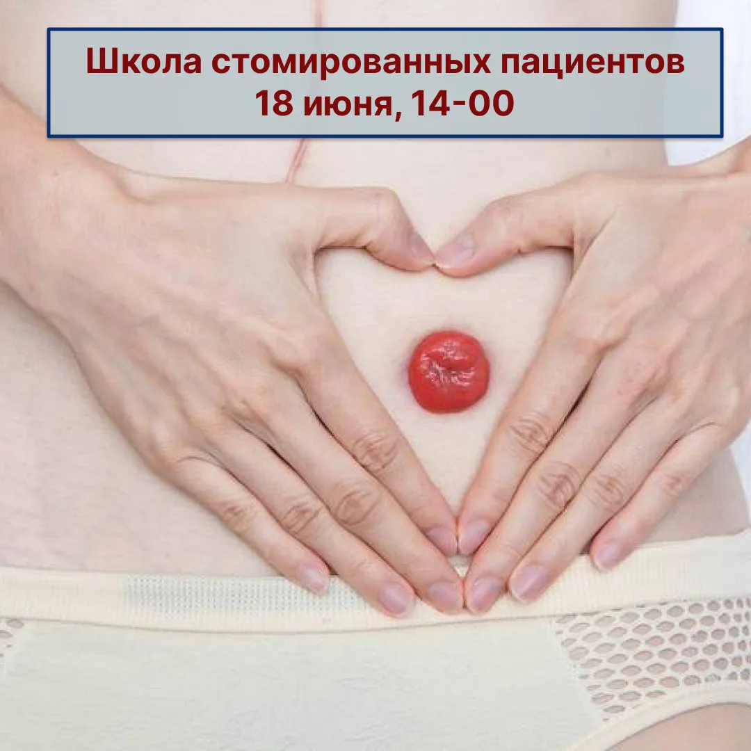❗Бесплатная Школа стомированных пациентов пройдет в Барнауле. На мероприятии обсудят особенности ухо